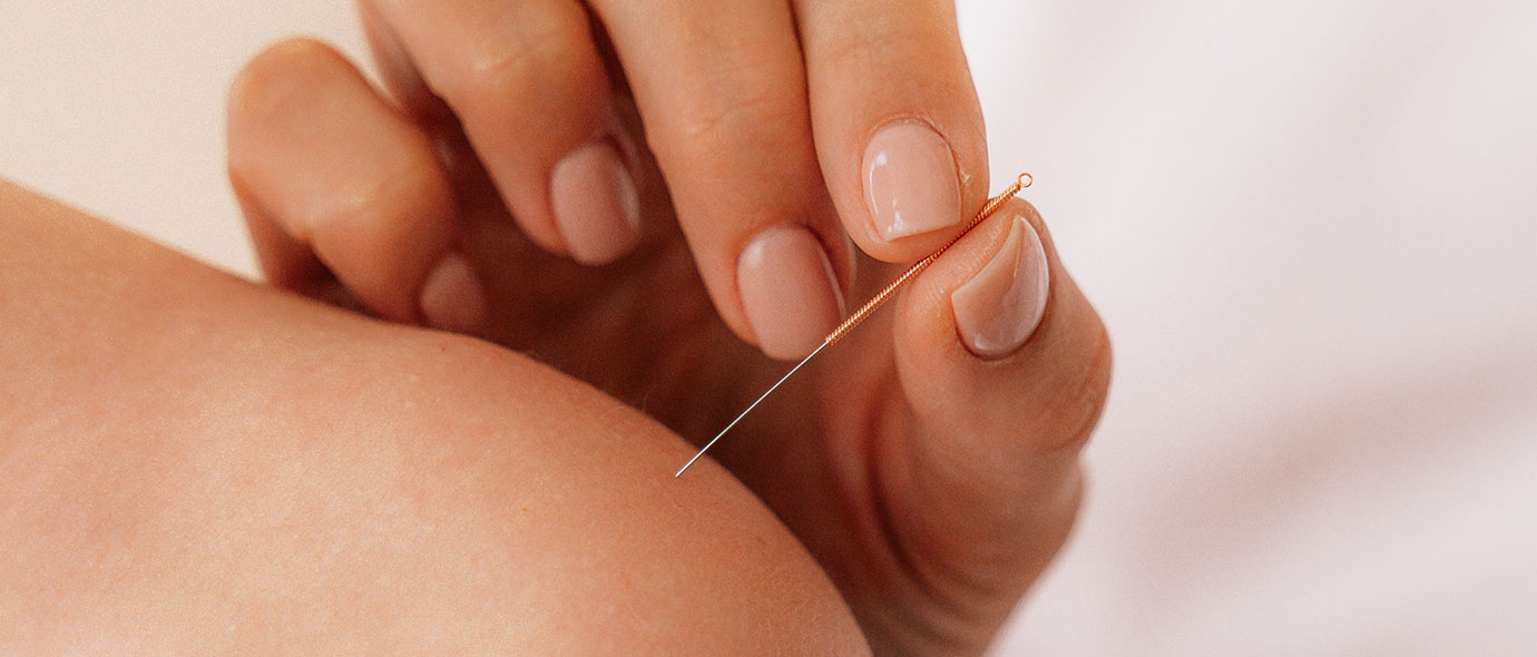 Acupuntura: entendimiento global del cuerpo